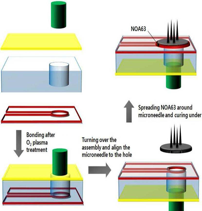 마이크로니들 및 마이크로펌프 장착 과정.