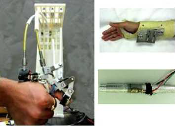 Actuated Thumb Exoskeleton (ATX)