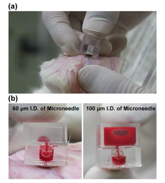 (a) 토끼 귀 동맥의 혈액채취 디바이스를 응용; (b) 60 ㎛ 및 100 ㎛ 내경의 마이크로니들을 장착한 디바이스의 챔버내에 채취된 혈액 샘플.