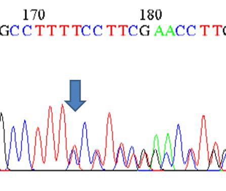 DARC 유전자 intron (IVS1) 235T/T deletion SNP (Heterozygote형)