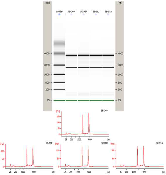 추출된 RNA의 QC를 위한 Migration pattern (electrophoretic trace)과 Peak pattern (electropherogram) 분석