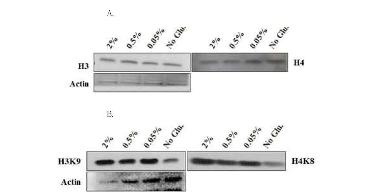 Glucose 정도에 따른 core histone과 histone acetylation의 변화