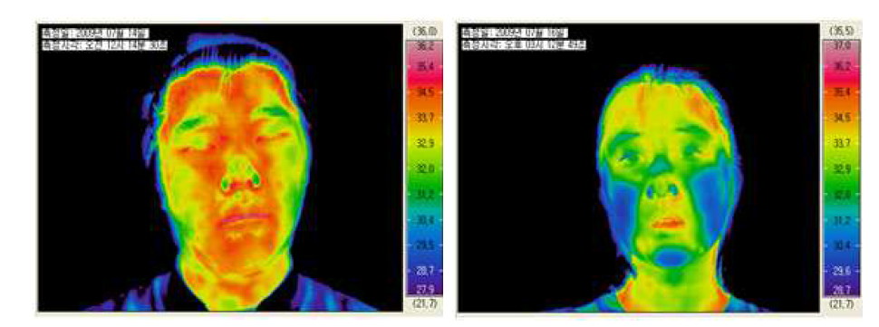 안면온도 비교 결과