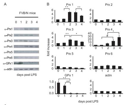 Plasma b cell 분화 과정중의 항산화효소의 변화