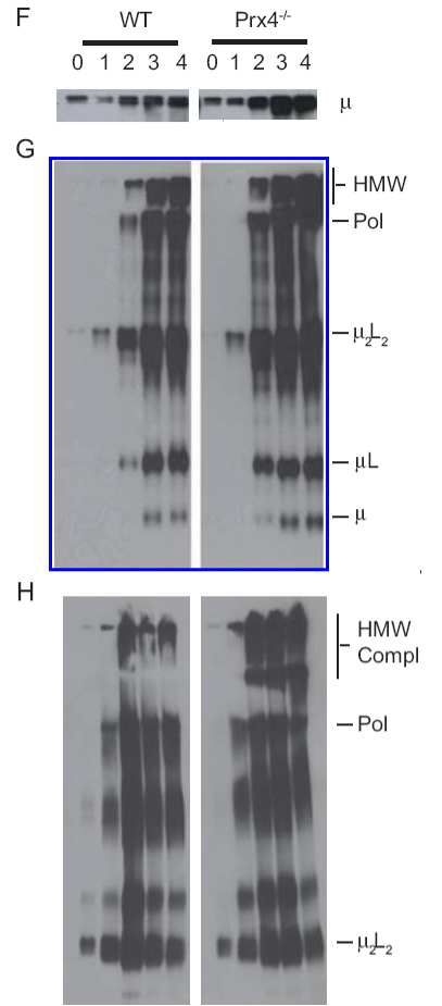 Polymerization of IgM 과 mu-chain 양 확인