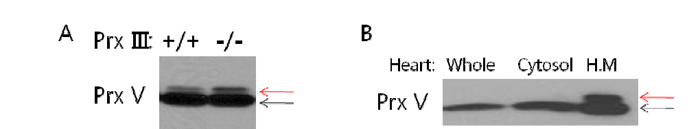 마우스 심장에서 Prx V의 새로운 형태 확인