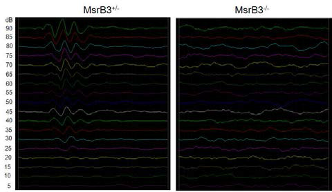 ABR test for hearing ability