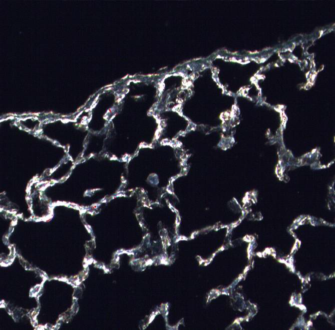 MWCNTs labelled as red dots with high magnification are retained in the lung cells and macrophages after 90 days of MWCNT inhalation exposure