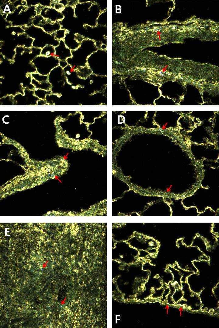 13주(90일)간 비부흡입 노출 종료 후 1일 고농도군(1.0 mg/m3) 랫드의 폐조직 고분광 나노영상. (A) 폐포 및 폐포 대식세포 (B) 기관지, (C) 기관지 분지, (D) 세기관지, (E) 림프절, (F) 흉막