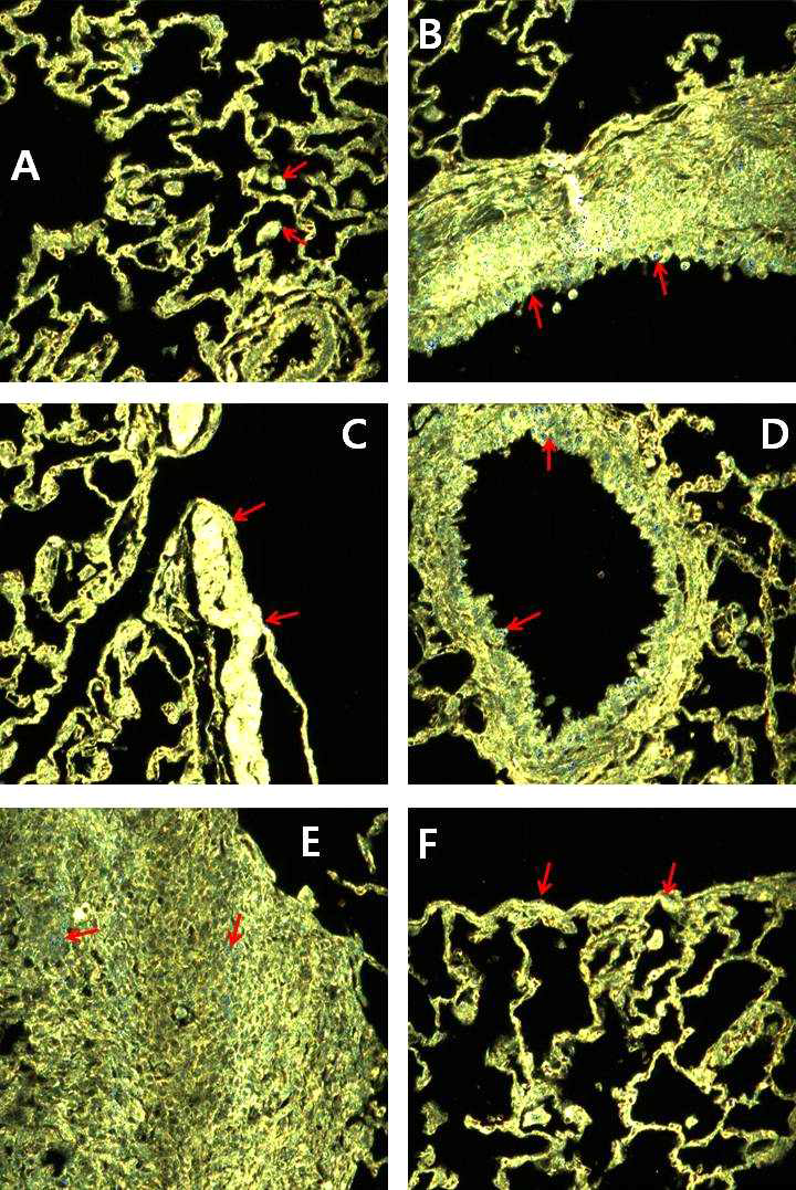 13주(90일)간 비부흡입 노출 종료 후 90일 저농도군(0.2 mg/m3) 랫드의 폐조직 고분광 나노영상. (A) 폐포 및 폐포 대식세포 (B) 기관지, (C) 기관지 분지, (D) 세기관지, (E) 림프절, (F) 흉막