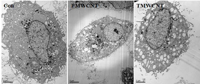 TEM image (16HBE14o- cell line, MWCNT 처리 48h 후)