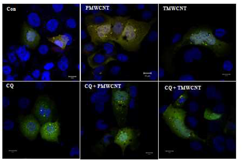 16HBE14o- cell line에서의 ptf-LC3 vector의 발현