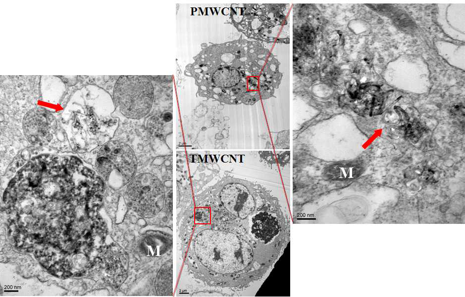 TEM image of PMWCNT and TMWCNT treated cell