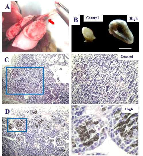 TMWCNT 투여 4개월 후 Mediastinal lymph node (LN)의 변화.