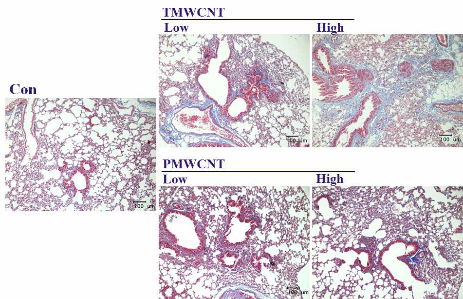 Masson’s trichrome staining in 1year MWCNT treated mice.