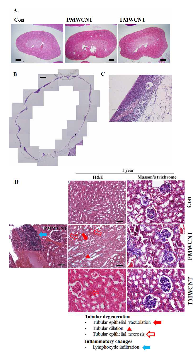 폐로의 MWCNT노출 1년 후의 신장의 조직학적 변화