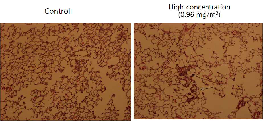 MWCNT 5일 노출, 30일 회복후의 폐 조직병리 (화살표, 폐포벽 비후)