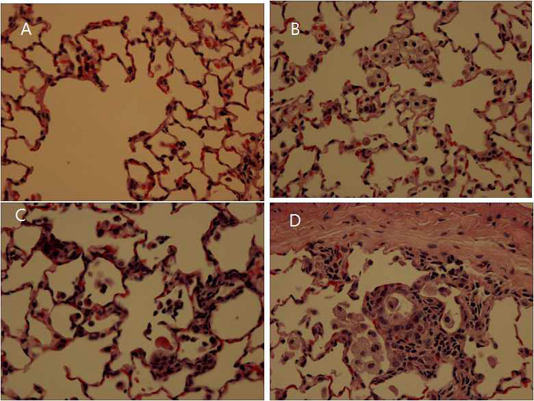 MWCNT 5 노출, 90일 회복후의 폐 조직병리