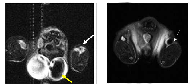 NIR-코어 실리카 나노입자의 림프절 MRI 조형 효과