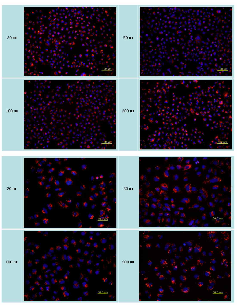 입자의 크기별 RITC-실리카 나노입자의 세포탐식 결과