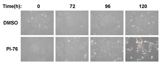 PI-76이 시간 의존적으로 사람의 폐암세포인 A549의 cytotoxicity를 증가시키는 효과
