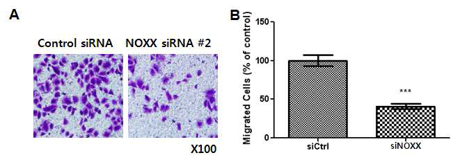 폐암 세포주인 HOP-92 세포에서 NOXX 발현 억제에 따른 세포 이동 변화 A. 세포 이동을 보이는 현미경 사진 B. A를 수치화 한 그래프