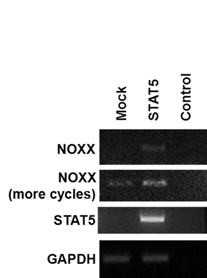 유방암 세포주인 SKBR3에서 STAT5의 과발현에 의한 NOXX 발현 변화