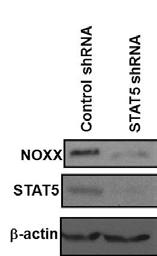 유방암 세포주인 SKBR3에서 STAT5의 shRNA에 의한 NOXX 발현 변화