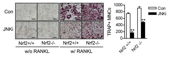 BMMs were preincubated with 10 μM SP600125 for 24 h, and then treated with 100 ng/ml of RANKL for 3 days. The cells were stained for TRAP (left panels) and the TRAP-positive MNCs were counted (right panel) as described in Fig. 1. Scale bar, 200 mm. The values are means ± SD. n=3. **P< 0.005