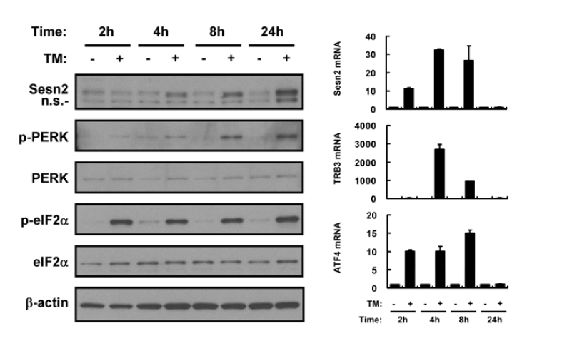 Tunicamycin induces Sestrin 2 expression in mouse liver