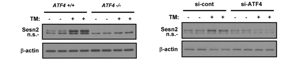 ER stress-induced induction of Sestrin 2 is dependent on ATF4