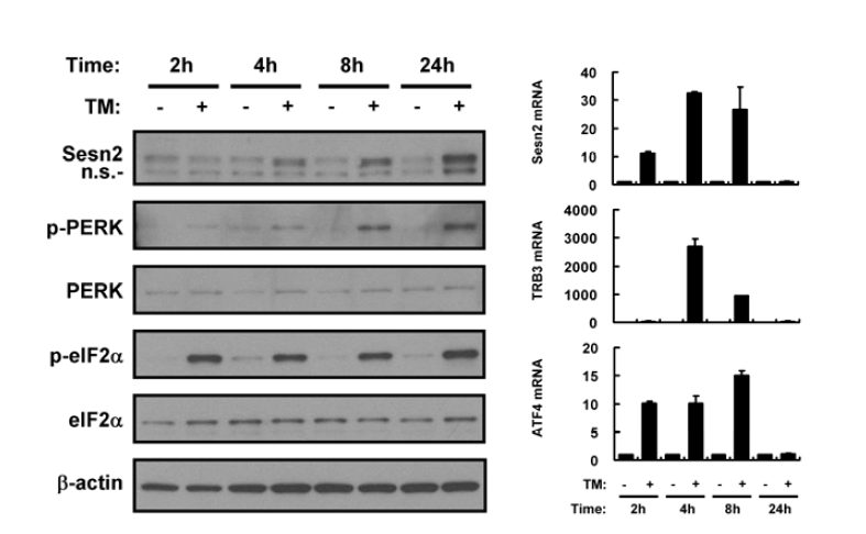 Tunicamycin induces Sestrin 2 expression in mouse liver