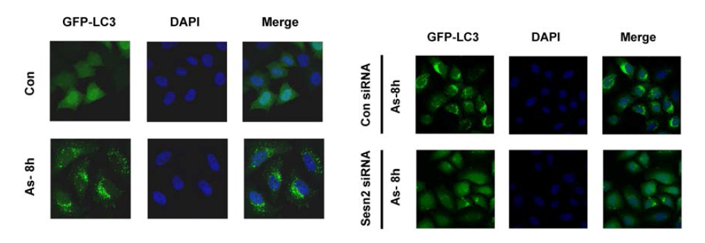 Sestrin 2 knockdown ameliorates As-induced autophagy