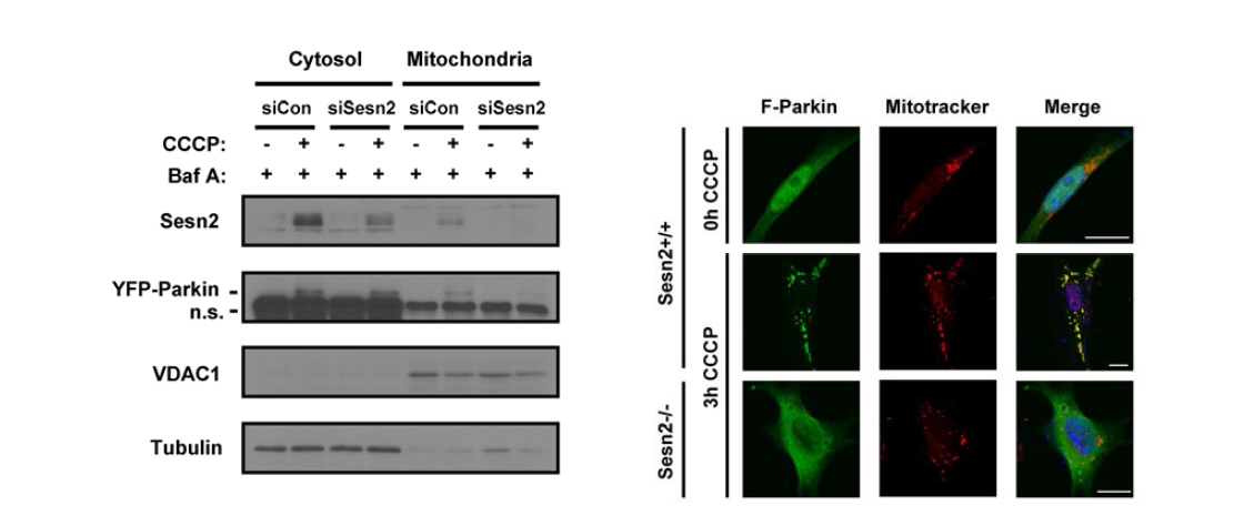 Sestrin 2 promotes CCCP-induced translocation of Parkin