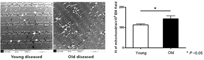 근육 조직에 대한 전자현미경 사진 및 미토콘드리아 개수 분석