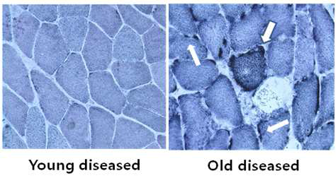 연령에 따른 근육세포의 변화