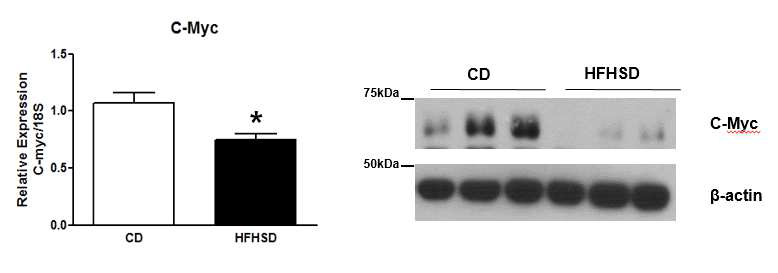 C-Myc expression in skeletal muscle of diet induced obesity rodent