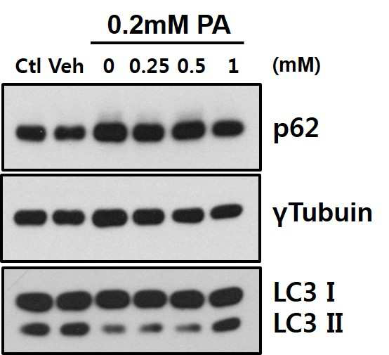 palmitic acid를 처리한 상태에서L-carnitine의 autophagy/mitophagy 조절 효과 확인