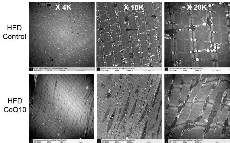 CoQ10 투여 후 근육내 미토콘드리아 증가 확인