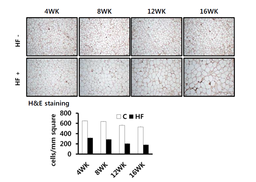 High fat diet에 의한 마우스의 지방세포 크기 증가