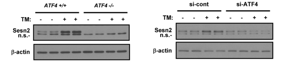 ER stress-induced induction of Sestrin 2 is dependent on ATF4