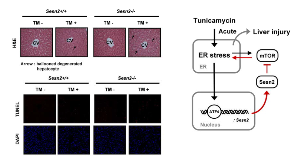 Ablation of Sestrin 2 augments liver damage and proposed model