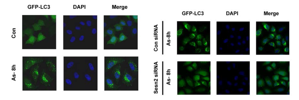 Sestrin 2 knockdown ameliorates As-induced autophagy