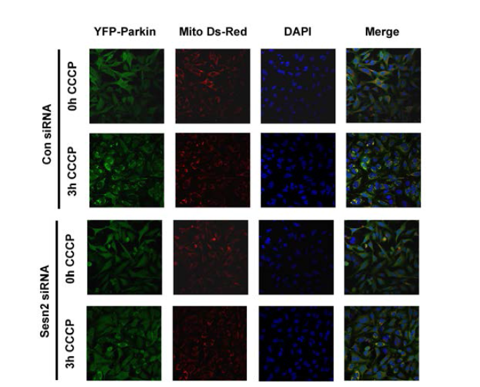Knockdown of Sestrin 2 attenuates CCCP-induced translocation of Parkin
