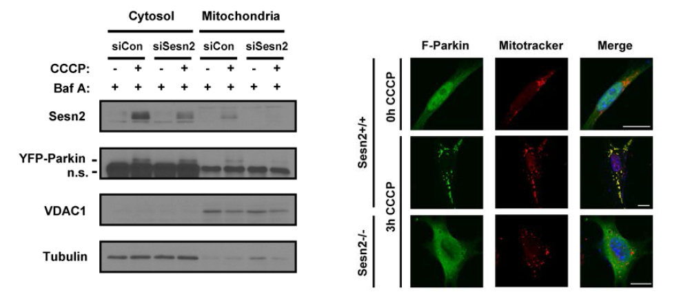 Sestrin 2 promotes CCCP-induced translocation of Parkin