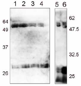 아토피 환자의 혈청에서 TCTP 이량체 검출