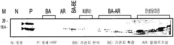 다양한 알레르기 환자의 혈청에서 TCTP 검출