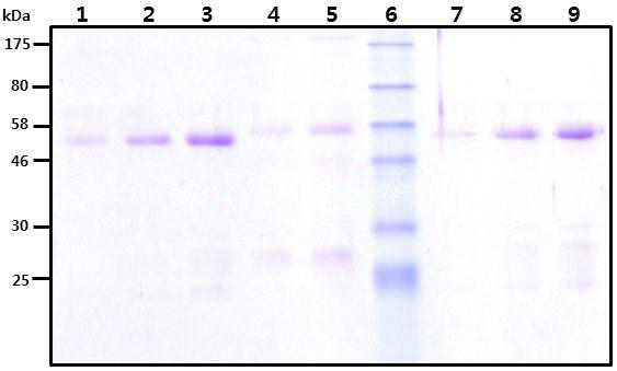 Affinity chromatography 정제 후 항체(IgG)의 SDS-PAGE 결과
