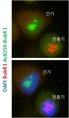 항원 접종이 끝난 토끼에서 채혈한 serum으로 세포분열 전중기 BubR1- acetylation을 염색