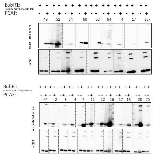 In vitro acetylation된 BubR1을 특이적으로 인지하고 결합하는 hybridoma 세포주 스크리닝